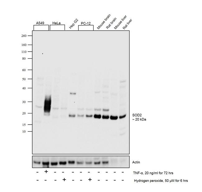 SOD2 (MnSOD) Antibody in Western Blot (WB)