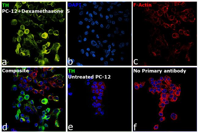 Tyrosine Hydroxylase Antibody