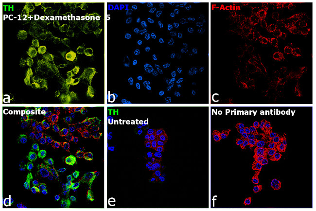 Tyrosine Hydroxylase Antibody in Immunocytochemistry (ICC/IF)