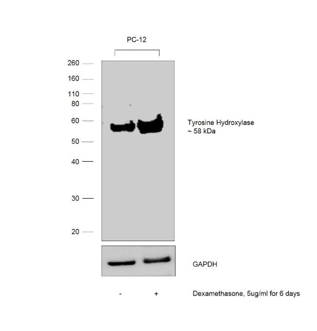 Tyrosine Hydroxylase Antibody in Western Blot (WB)