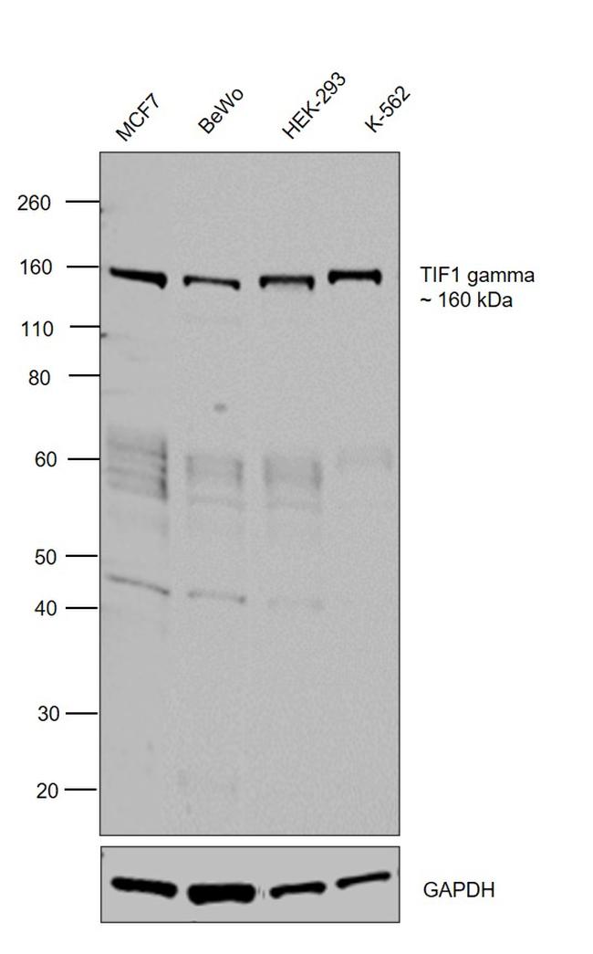 TIF1 gamma Antibody in Western Blot (WB)