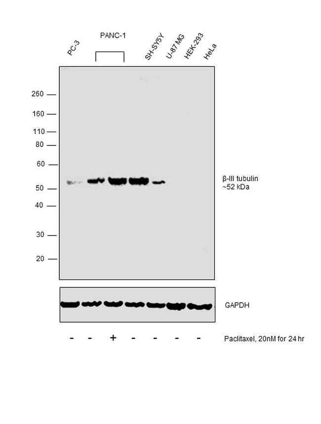 Beta III Tubulin Antibody in Western Blot (WB)