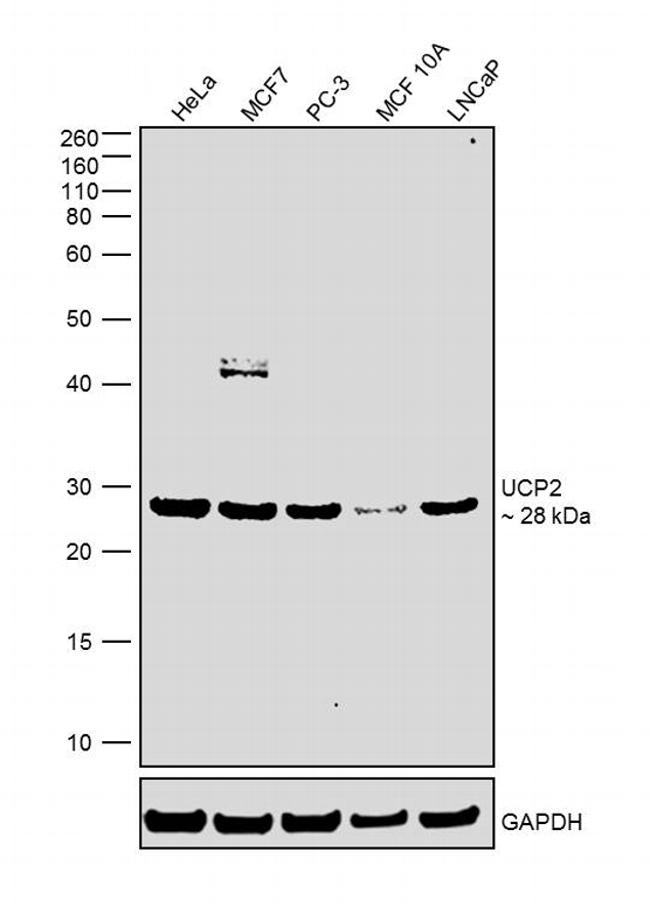 UCP2 Antibody in Western Blot (WB)