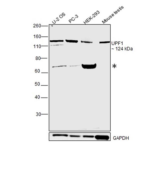 UPF1 Antibody in Western Blot (WB)