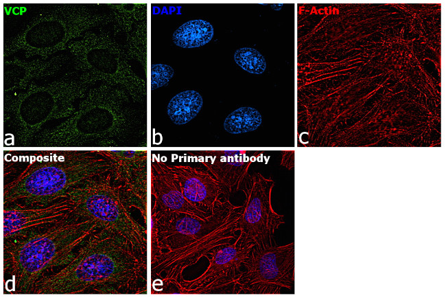 VCP Antibody in Immunocytochemistry (ICC/IF)