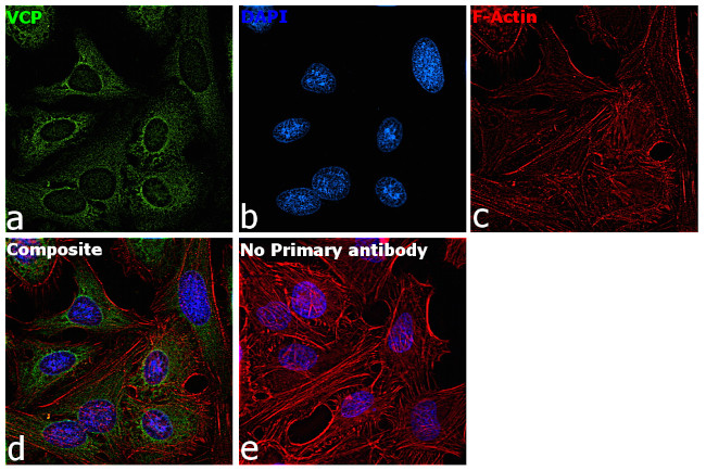 VCP Antibody in Immunocytochemistry (ICC/IF)