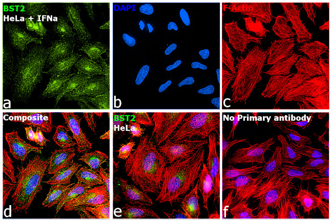 BST-2 Antibody in Immunocytochemistry (ICC/IF)