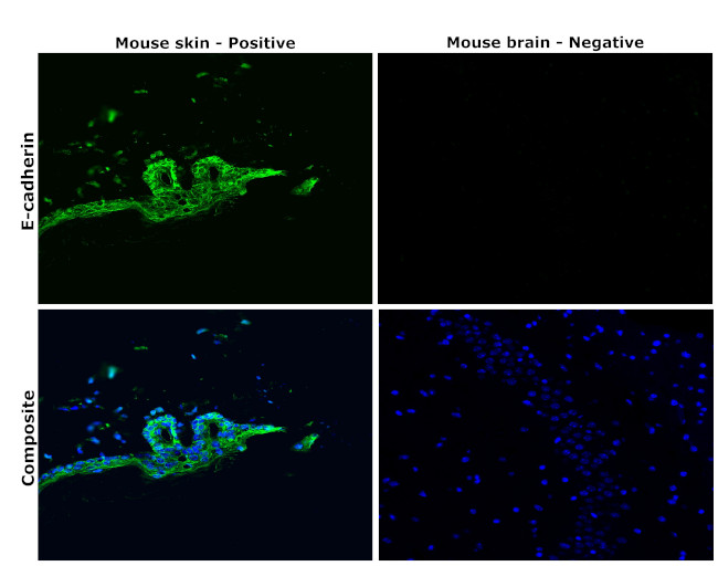 E-cadherin Antibody in Immunohistochemistry (Paraffin) (IHC (P))