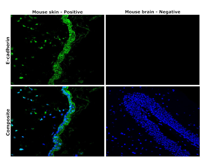 E-cadherin Antibody in Immunohistochemistry (Paraffin) (IHC (P))