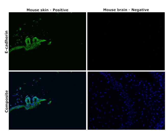 E-cadherin Antibody