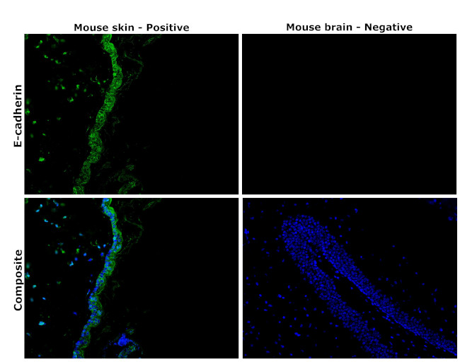 E-cadherin Antibody in Immunohistochemistry (Paraffin) (IHC (P))