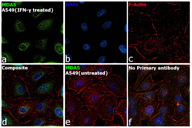 MDA5 Antibody in Immunocytochemistry (ICC/IF)