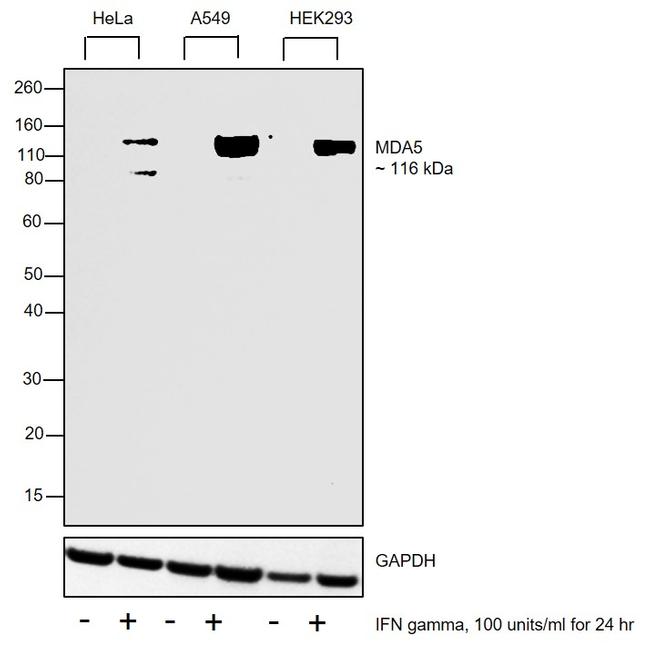 MDA5 Antibody in Western Blot (WB)