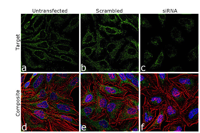 Nesprin 1 Antibody in Immunocytochemistry (ICC/IF)