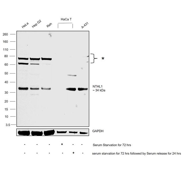 NTHL1 Antibody in Western Blot (WB)