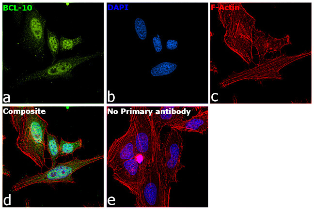 Bcl-10 Antibody in Immunocytochemistry (ICC/IF)