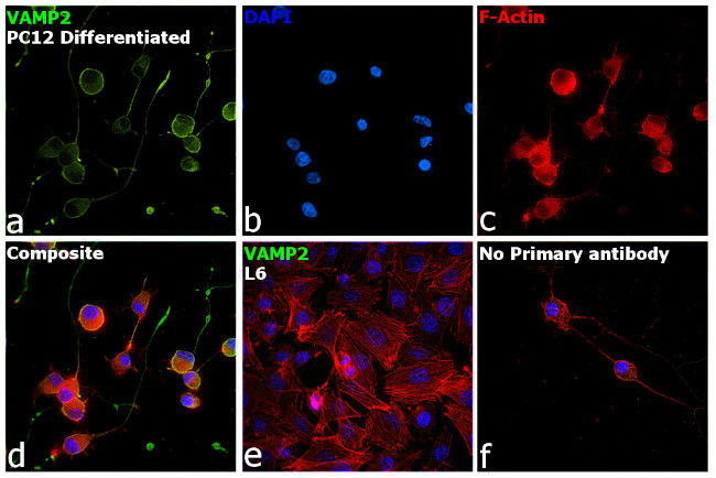 VAMP2 Antibody in Immunocytochemistry (ICC/IF)