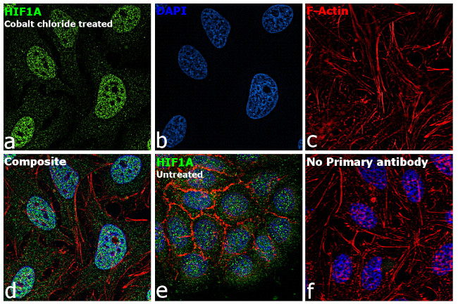 HIF1A Antibody in Immunocytochemistry (ICC/IF)