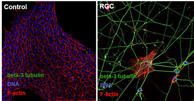 beta-3 Tubulin Antibody in Immunocytochemistry (ICC/IF)