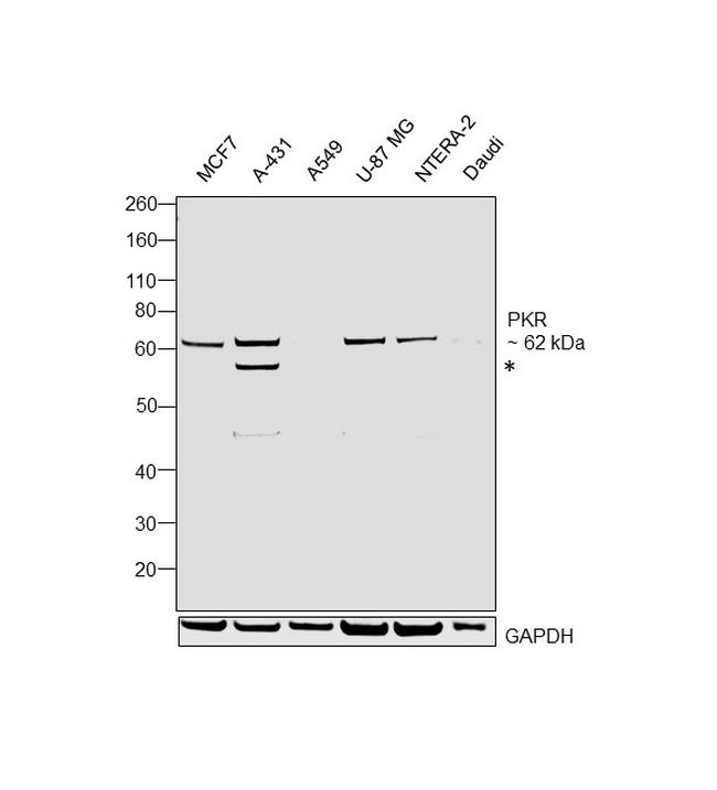 PKR Antibody in Western Blot (WB)