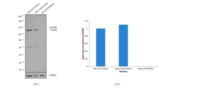 STAT5 beta Antibody in Western Blot (WB)