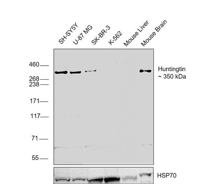 Huntingtin Antibody in Western Blot (WB)