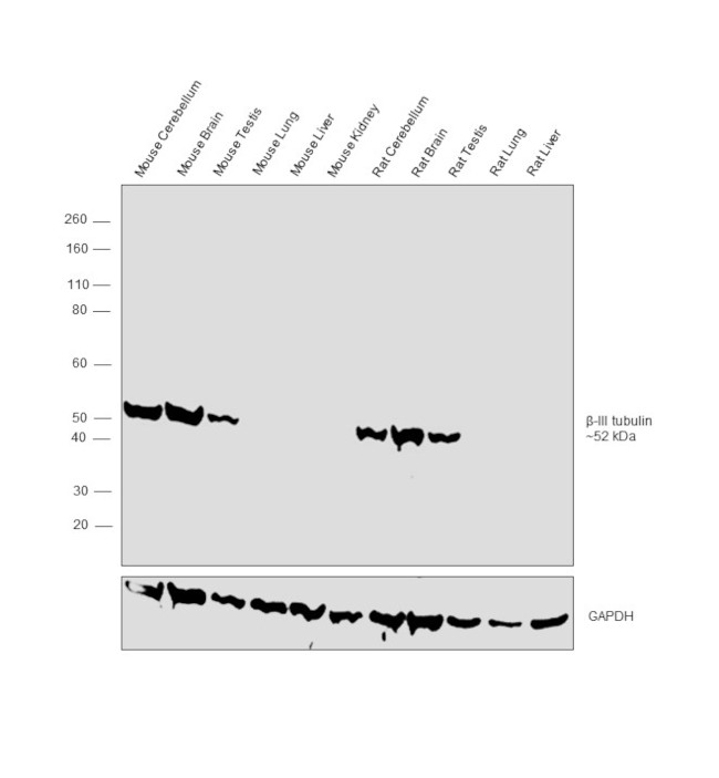 Beta III Tubulin Antibody