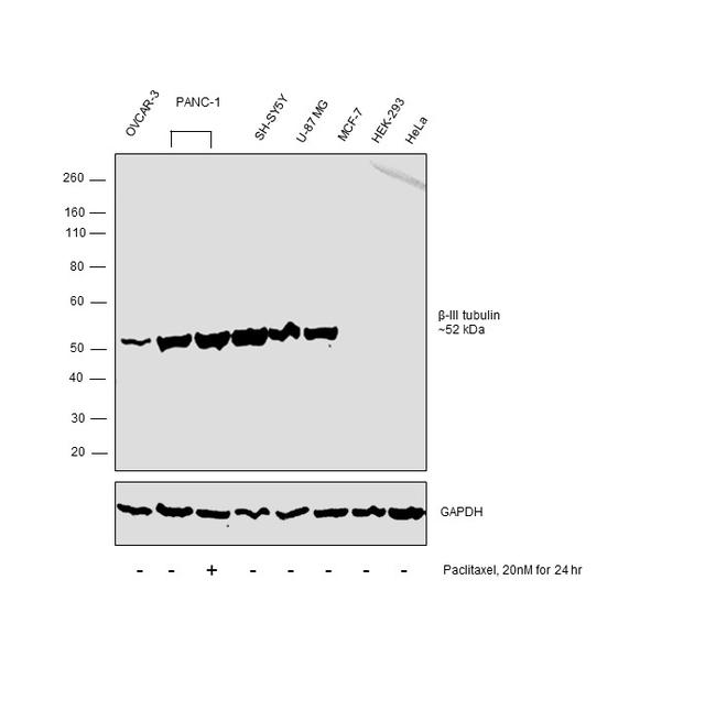 Beta III Tubulin Antibody in Western Blot (WB)