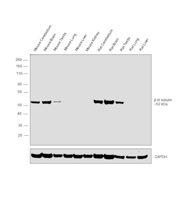 beta-3 Tubulin Antibody