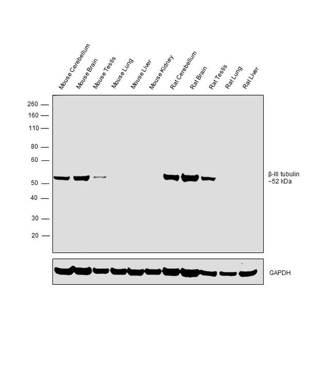 beta-3 Tubulin Antibody in Western Blot (WB)