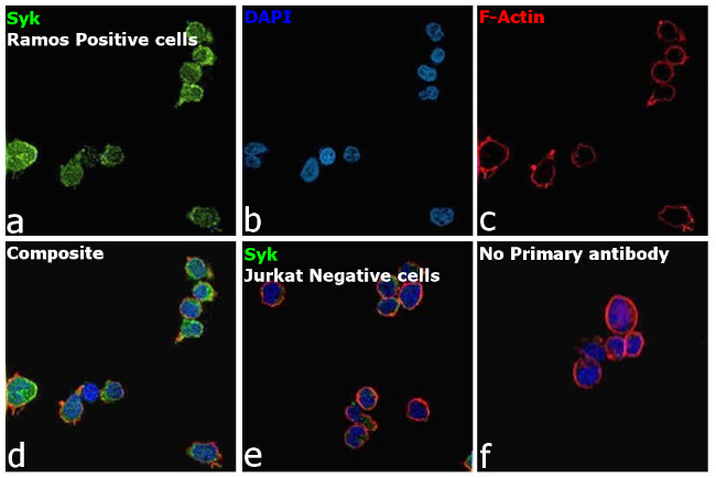 Syk Antibody in Immunocytochemistry (ICC/IF)