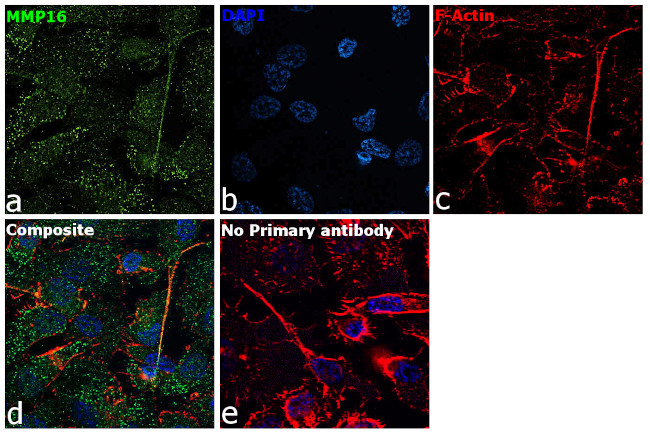 MMP16 Antibody in Immunocytochemistry (ICC/IF)