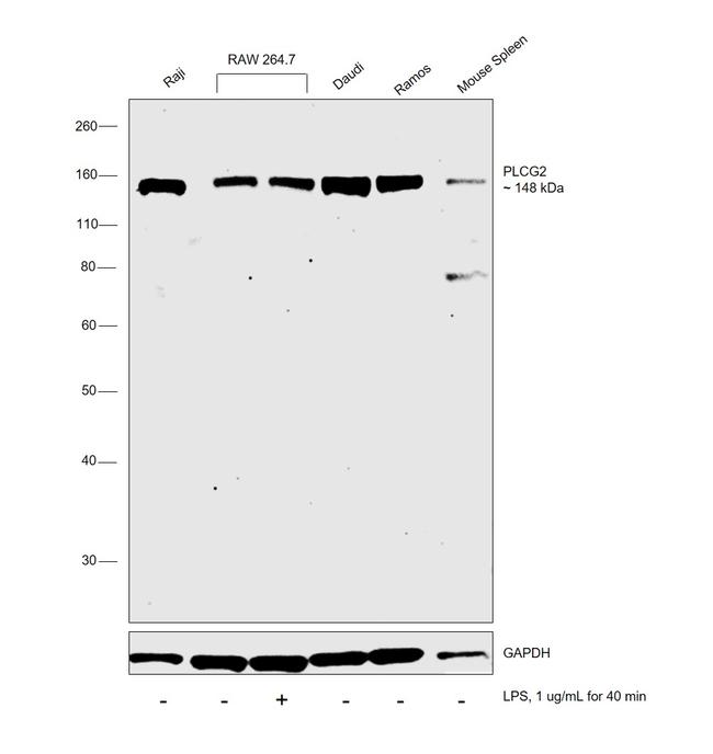 PLCG2 Antibody in Western Blot (WB)