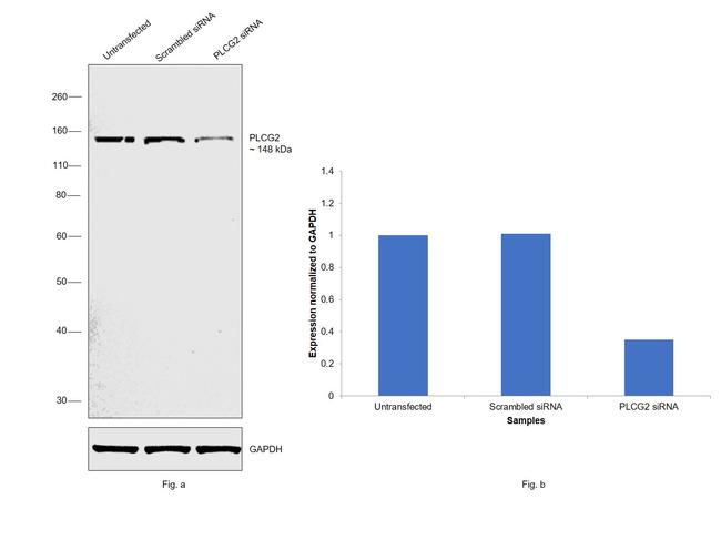 PLCG2 Antibody in Western Blot (WB)