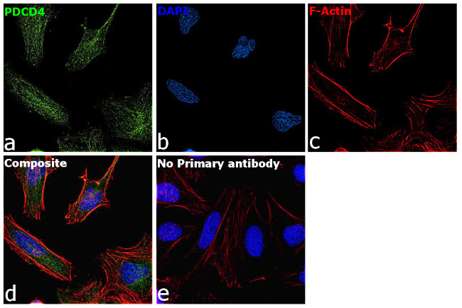 PDCD4 Antibody in Immunocytochemistry (ICC/IF)