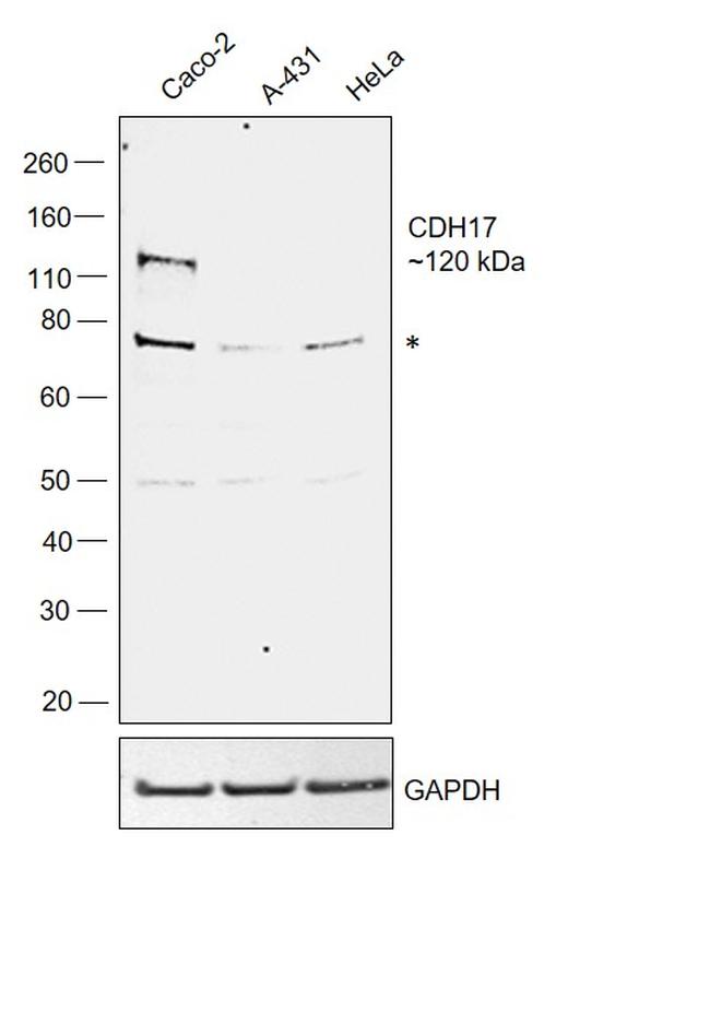 CDH17 Antibody in Western Blot (WB)