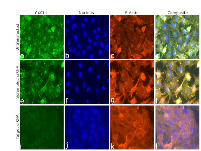 CXCL1 Antibody in Immunocytochemistry (ICC/IF)