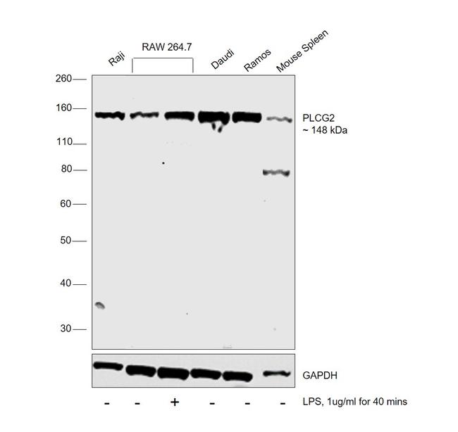 PLCG2 Antibody in Western Blot (WB)