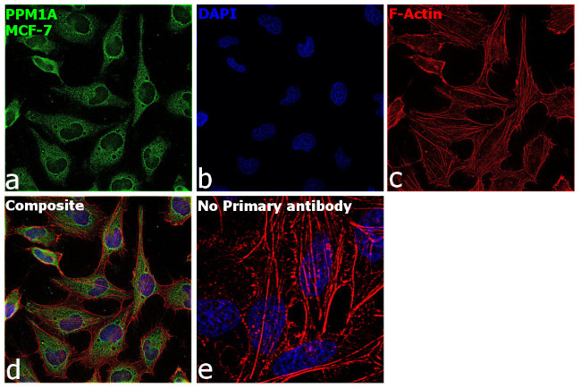 PPM1A Antibody in Immunocytochemistry (ICC/IF)