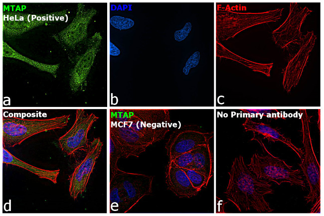 MTAP Antibody