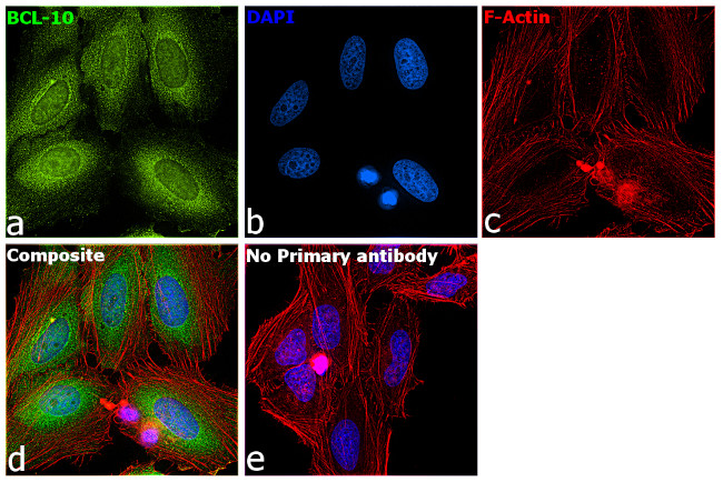 Bcl-10 Antibody in Immunocytochemistry (ICC/IF)