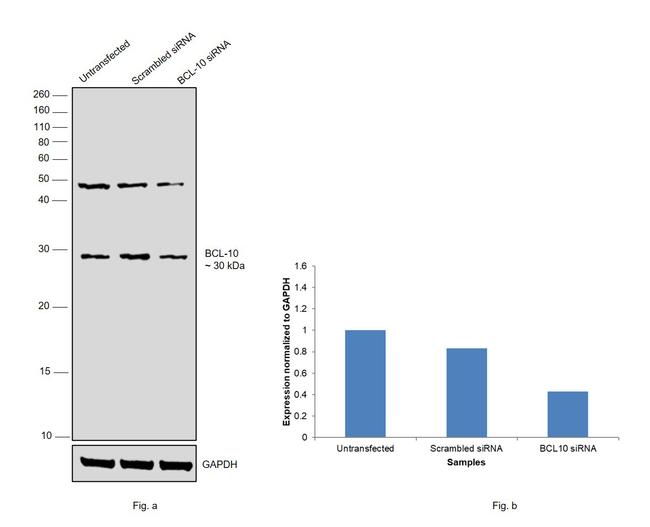 Bcl-10 Antibody in Western Blot (WB)