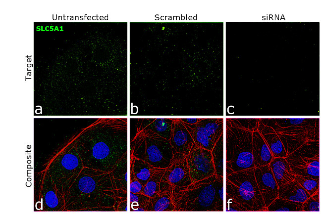 SGLT1 Antibody in Immunocytochemistry (ICC/IF)