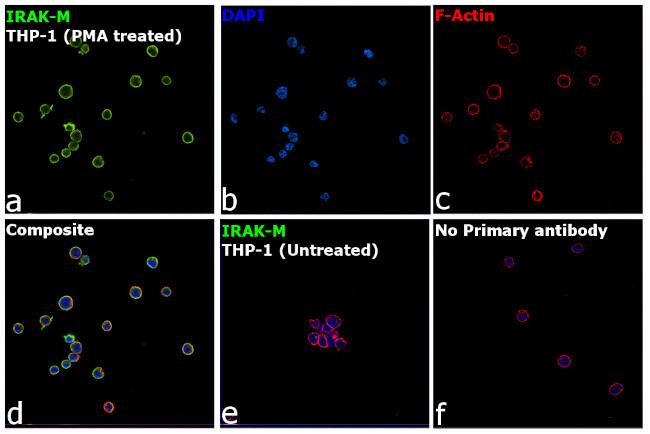 IRAK-M Antibody