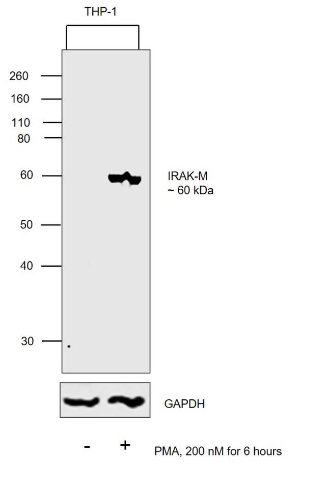 IRAK-M Antibody in Western Blot (WB)