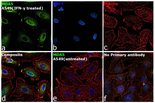 MDA5 Antibody