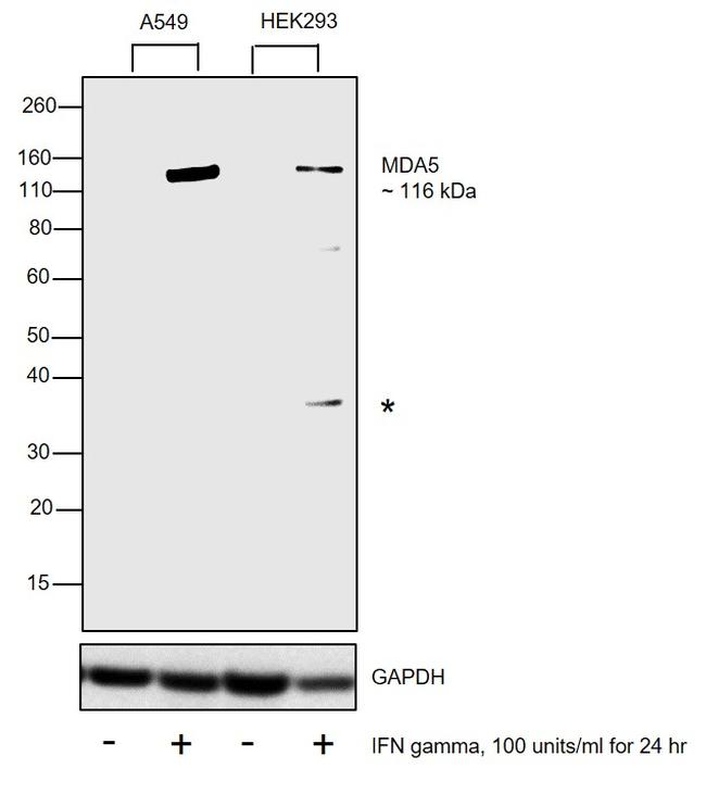 MDA5 Antibody in Western Blot (WB)