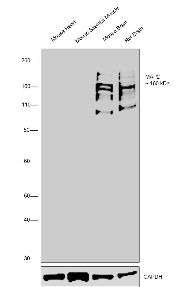 MAP2 Antibody in Western Blot (WB)