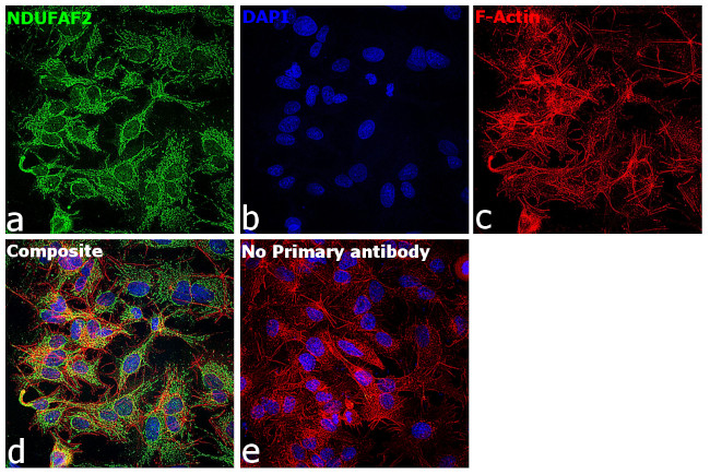 NDUFAF2 Antibody in Immunocytochemistry (ICC/IF)