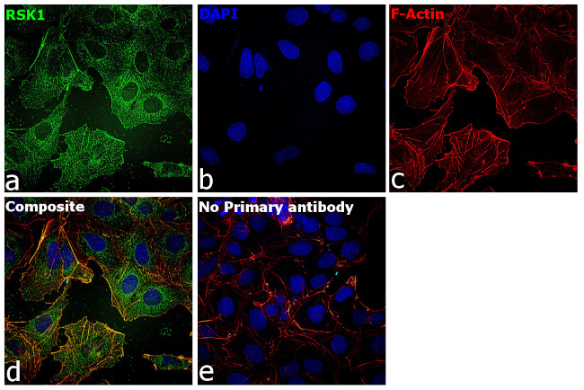 RSK1 Antibody in Immunocytochemistry (ICC/IF)